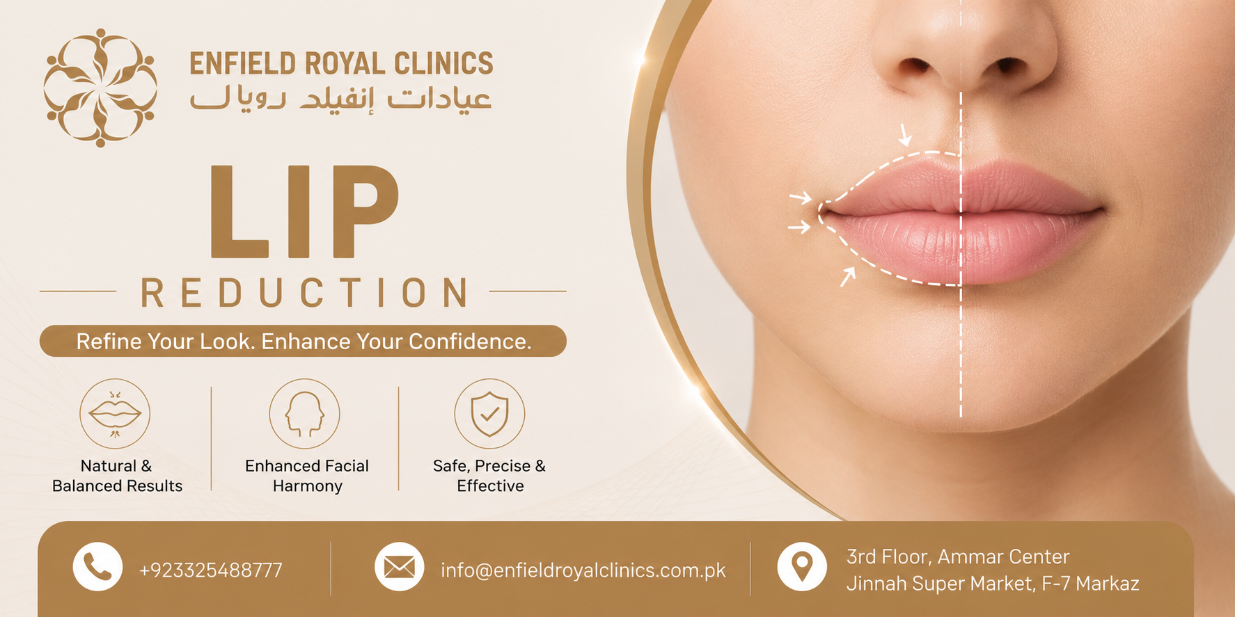 What Happens During Lip Reduction?